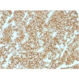 Immunohistochemistry - Anti-Parathyroid Hormone Antibody [PTH/1717R] - BSA and Azide free (A252949) - Antibodies.com