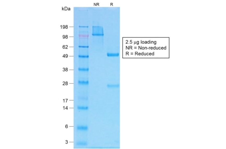 SDS-PAGE - Anti-Parathyroid Hormone Antibody [PTH/1717R] - BSA and Azide free (A252950) - Antibodies.com