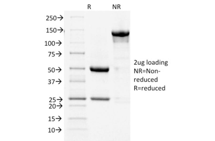 SDS-PAGE - Anti-COX2 Antibody [COX2/1941] - BSA and Azide free (A252951) - Antibodies.com