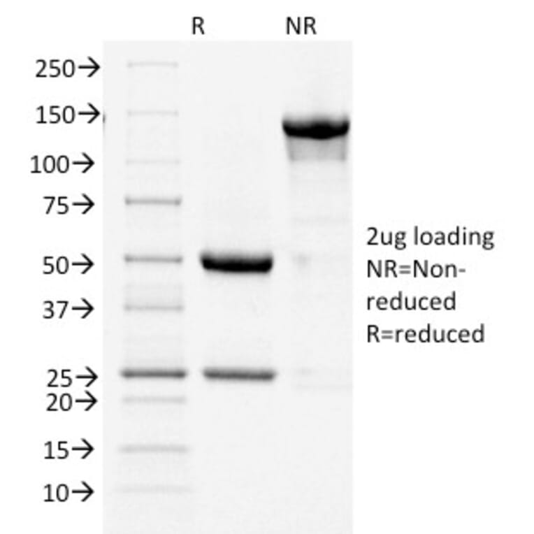 SDS-PAGE - Anti-COX2 Antibody [COX2/1941] - BSA and Azide free (A252951) - Antibodies.com