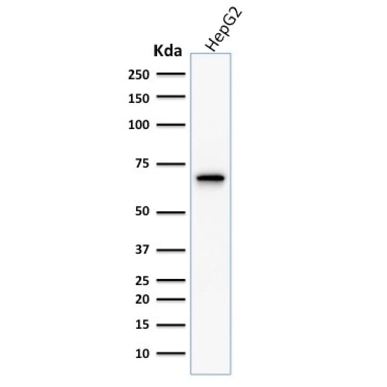 Western Blot - Anti-COX2 Antibody [COX2/1941] - BSA and Azide free (A252952) - Antibodies.com