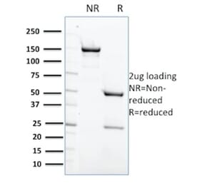 SDS-PAGE - Anti-SHP1 Antibody [CPTC-PTPN6-2] - BSA and Azide free (A252957) - Antibodies.com