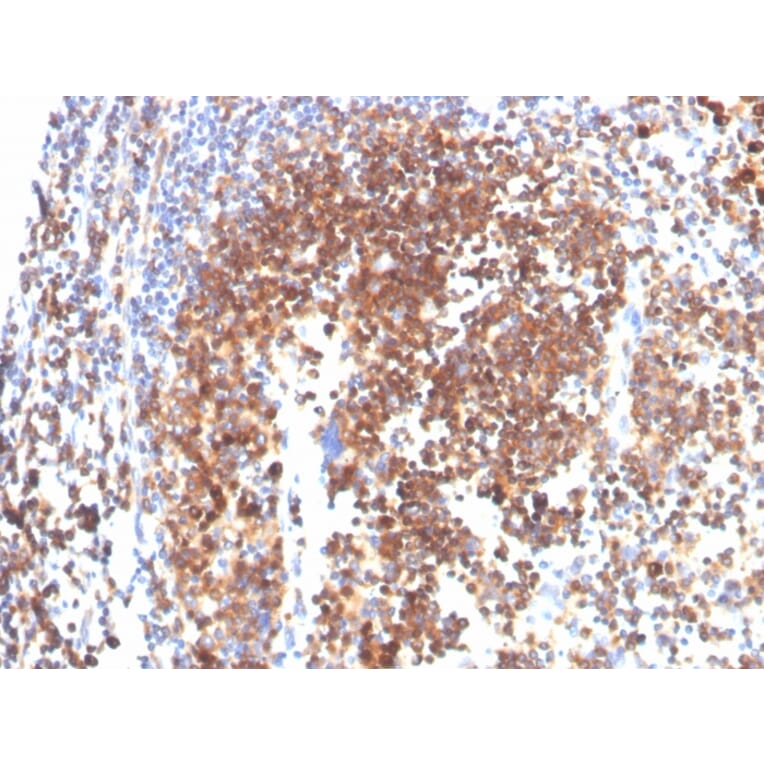 Immunohistochemistry - Anti-SLAMF7 Antibody [SLAMF7/3649] - BSA and Azide free (A252959) - Antibodies.com