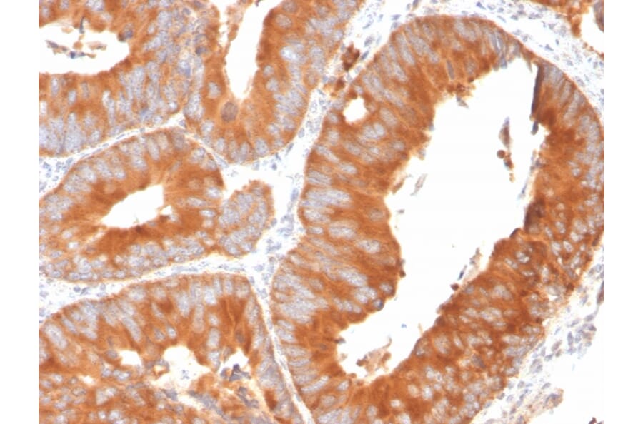 Immunohistochemistry - Anti-SLAMF7 Antibody [SLAMF7/3649] - BSA and Azide free (A252958) - Antibodies.com