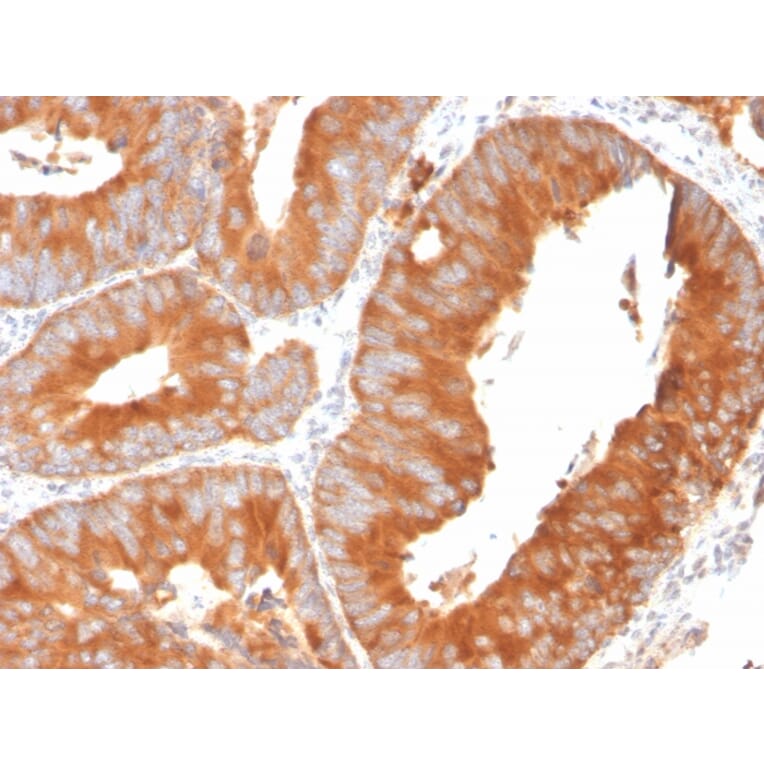 Immunohistochemistry - Anti-SLAMF7 Antibody [SLAMF7/3649] - BSA and Azide free (A252958) - Antibodies.com