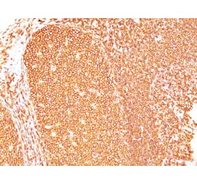 Immunohistochemistry - Anti-CD45 Antibody [Bra55] - BSA and Azide free (A252962) - Antibodies.com