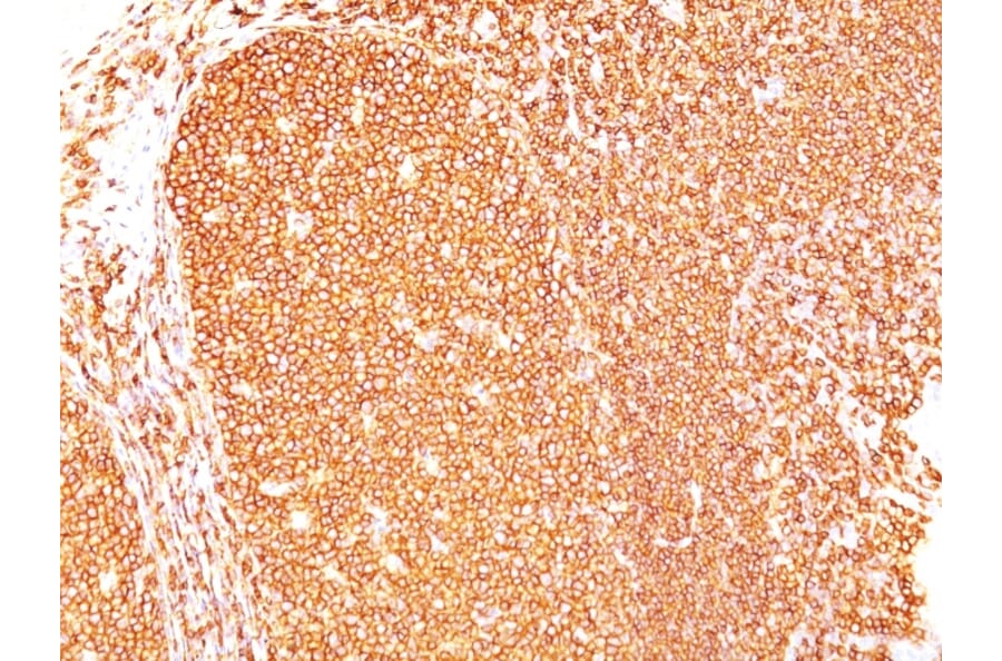 Immunohistochemistry - Anti-CD45 Antibody [Bra55] - BSA and Azide free (A252962) - Antibodies.com