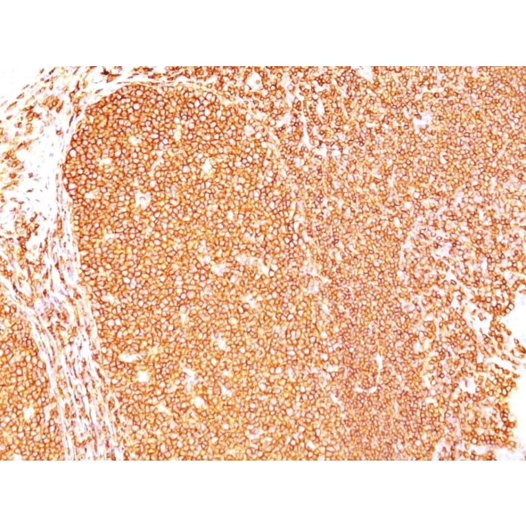 Immunohistochemistry - Anti-CD45 Antibody [Bra55] - BSA and Azide free (A252962) - Antibodies.com