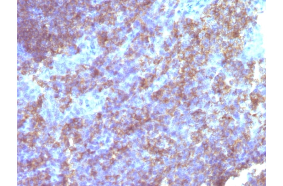 Immunohistochemistry - Anti-CD45 Antibody [Bra55] - BSA and Azide free (A252962) - Antibodies.com