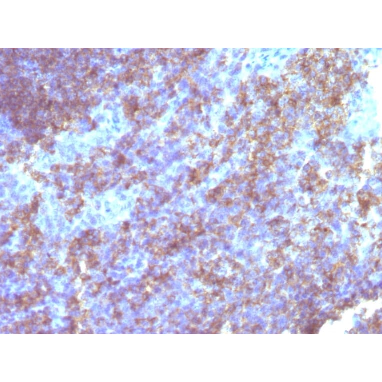 Immunohistochemistry - Anti-CD45 Antibody [Bra55] - BSA and Azide free (A252962) - Antibodies.com