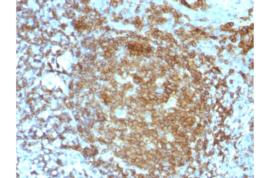 Immunohistochemistry - Anti-CD45RA Antibody [PTPRC/818] - BSA and Azide free (A252965) - Antibodies.com