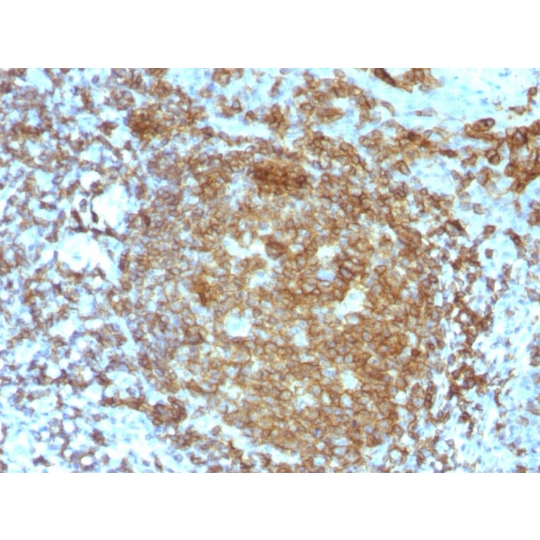 Immunohistochemistry - Anti-CD45RA Antibody [PTPRC/818] - BSA and Azide free (A252965) - Antibodies.com