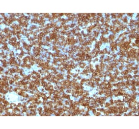Immunohistochemistry - Anti-CD45RA Antibody [PTPRC/1131] - BSA and Azide free (A252965) - Antibodies.com