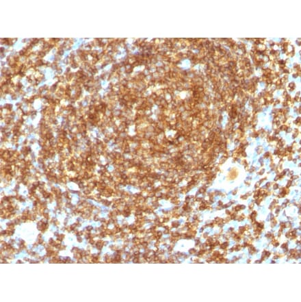 Immunohistochemistry - Anti-CD45RB Antibody [PTPRC/1132] - BSA and Azide free (A252967) - Antibodies.com