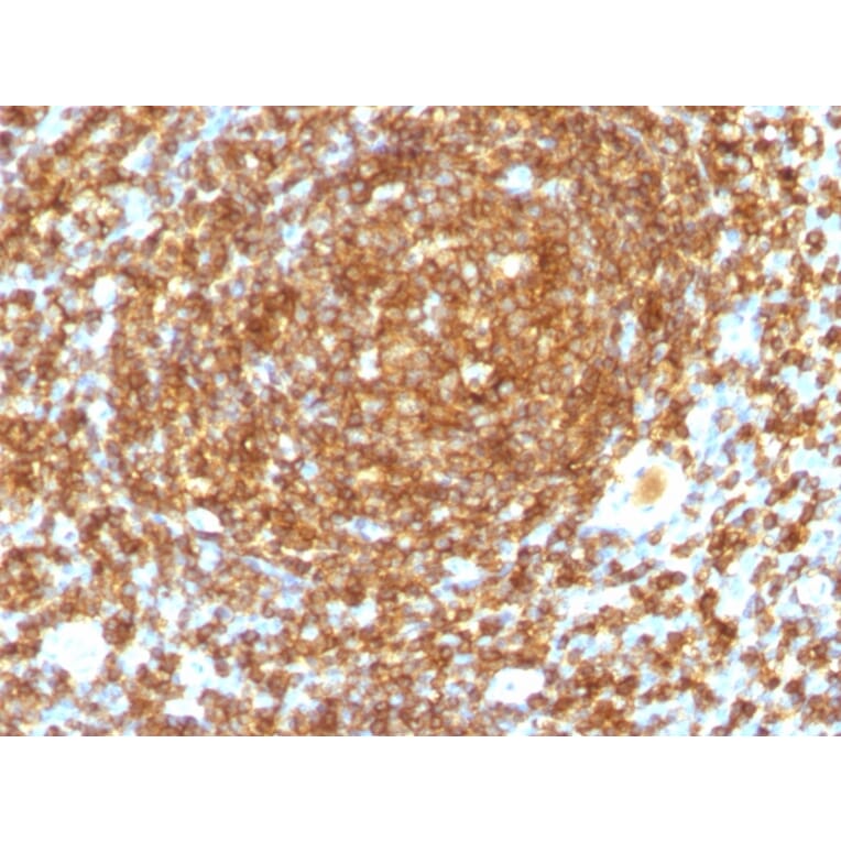Immunohistochemistry - Anti-CD45RB Antibody [PTPRC/1132] - BSA and Azide free (A252967) - Antibodies.com