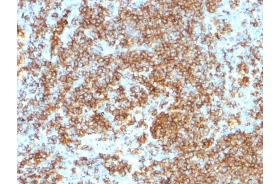 Immunohistochemistry - Anti-CD45RB Antibody [PTPRC/1132] - BSA and Azide free (A252966) - Antibodies.com