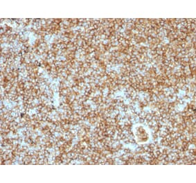 Immunohistochemistry - Anti-CD45RB Antibody [PTPRC/1147] - BSA and Azide free (A252967) - Antibodies.com