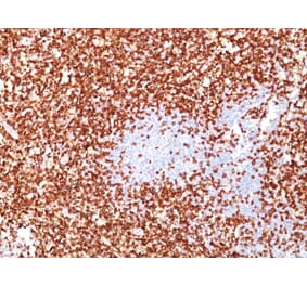 Immunohistochemistry - Anti-CD45RO Antibody [UCHL-1 + T200/797] - BSA and Azide free (A252969) - Antibodies.com