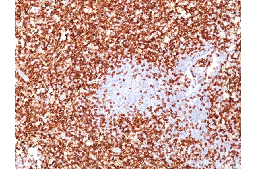 Immunohistochemistry - Anti-CD45RO Antibody [UCHL-1 + T200/797] - BSA and Azide free (A252969) - Antibodies.com