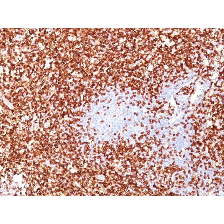 Immunohistochemistry - Anti-CD45RO Antibody [UCHL-1 + T200/797] - BSA and Azide free (A252969) - Antibodies.com