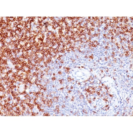 Immunohistochemistry - Anti-CD45RO Antibody [UCHL-1] - BSA and Azide free (A252971) - Antibodies.com