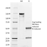 SDS-PAGE - Anti-CD45RO Antibody [UCHL-1] - BSA and Azide free (A252971) - Antibodies.com