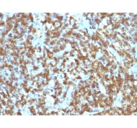 Immunohistochemistry - Anti-CD45RO Antibody [SPM125] - BSA and Azide free (A252971) - Antibodies.com