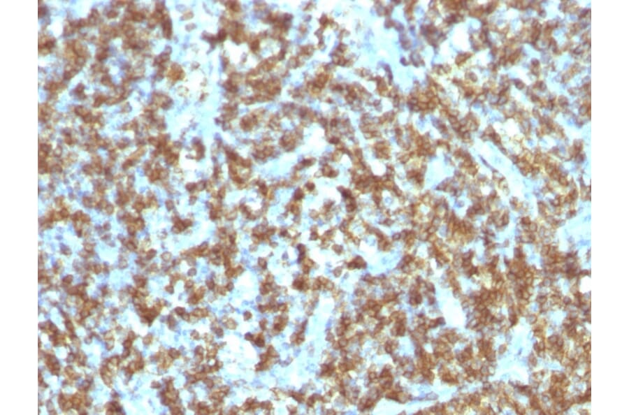 Immunohistochemistry - Anti-CD45RO Antibody [SPM125] - BSA and Azide free (A252971) - Antibodies.com