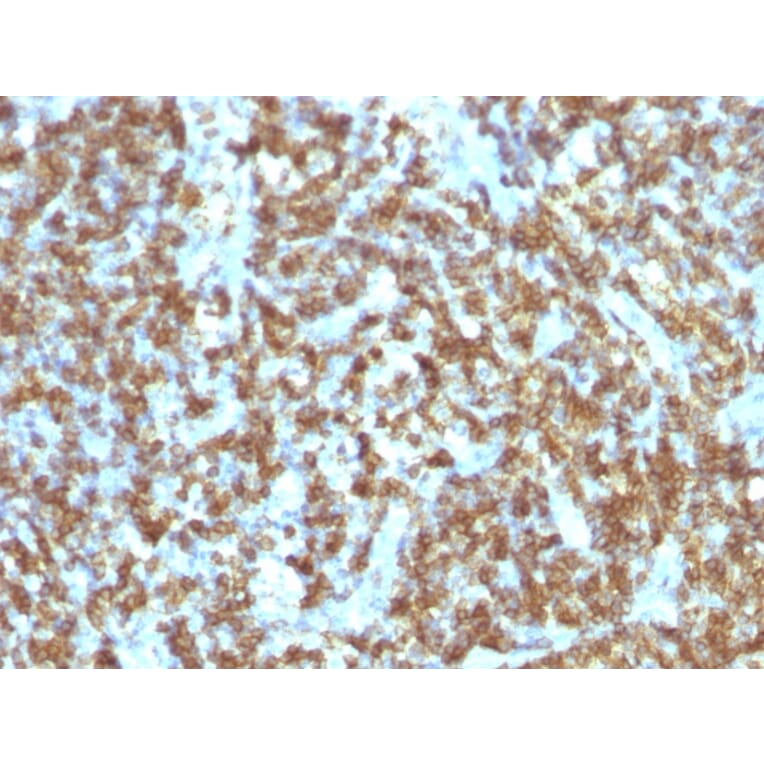 Immunohistochemistry - Anti-CD45RO Antibody [SPM125] - BSA and Azide free (A252971) - Antibodies.com