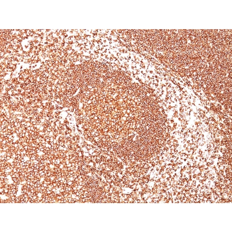 Immunohistochemistry - Anti-CD45 Antibody [PTPRC/1461] - BSA and Azide free (A252974) - Antibodies.com