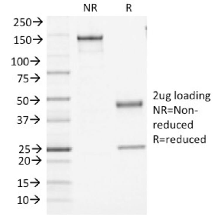 SDS-PAGE - Anti-CD45 Antibody [PTPRC/1461] - BSA and Azide free (A252974) - Antibodies.com
