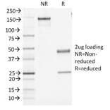 SDS-PAGE - Anti-CD45 Antibody [PTPRC/1461] - BSA and Azide free (A252974) - Antibodies.com