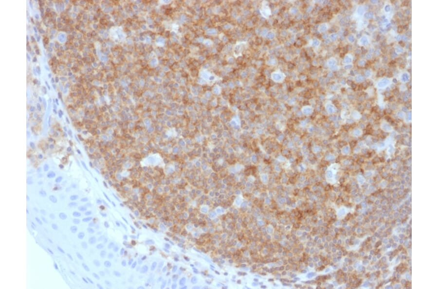 Immunohistochemistry - Anti-CD45 Antibody [F10-89-4] - BSA and Azide free (A252975) - Antibodies.com