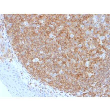 Immunohistochemistry - Anti-CD45 Antibody [F10-89-4] - BSA and Azide free (A252975) - Antibodies.com