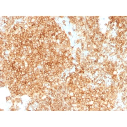 Immunohistochemistry - Anti-CD45 Antibody [PTPRC/1147 + PTPRC/1460] - BSA and Azide free (A252975) - Antibodies.com