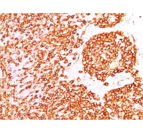 Immunohistochemistry - Anti-CD45 Antibody [rPTPRC/1460] - BSA and Azide free (A252978) - Antibodies.com