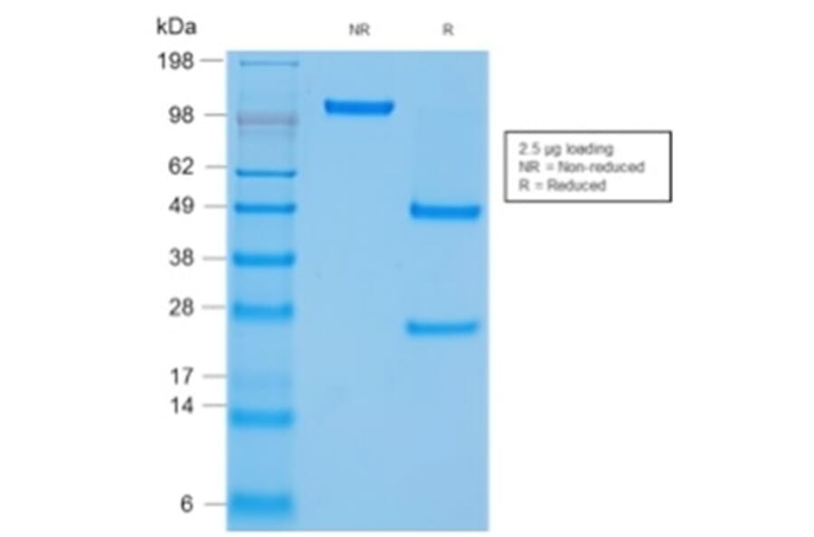 SDS-PAGE - Anti-CD45 Antibody [rPTPRC/1460] - BSA and Azide free (A252978) - Antibodies.com