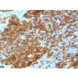Immunohistochemistry - Anti-CD45RA Antibody [SPM568] - BSA and Azide free (A252980) - Antibodies.com