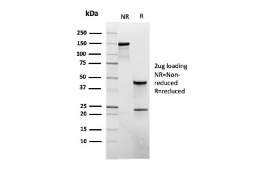 SDS-PAGE - Anti-CD45RB Antibody [rPTPRC/1132] - BSA and Azide free (A252981) - Antibodies.com