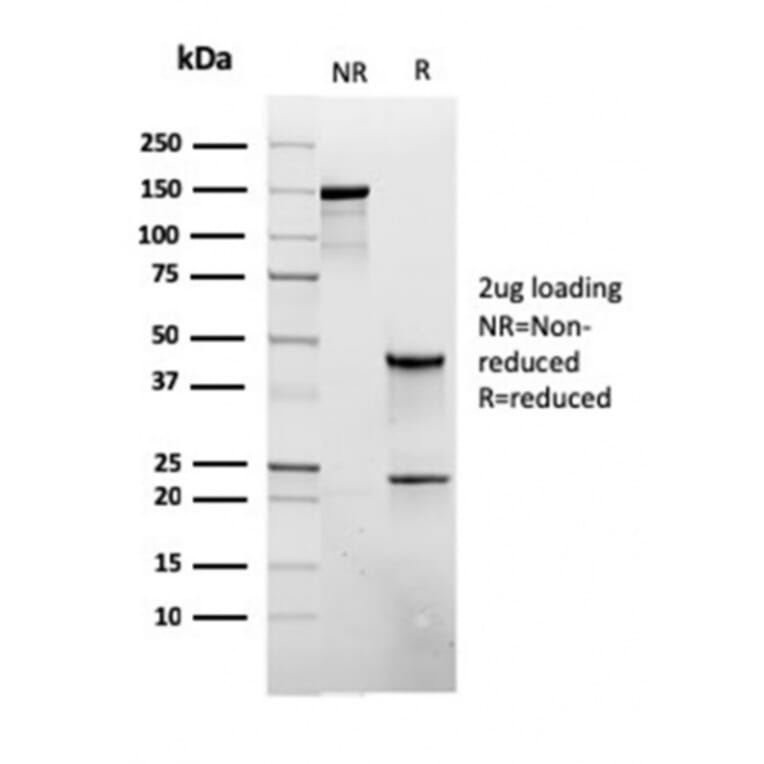 SDS-PAGE - Anti-CD45RB Antibody [rPTPRC/1132] - BSA and Azide free (A252981) - Antibodies.com