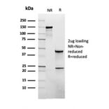 SDS-PAGE - Anti-CD45RB Antibody [rPTPRC/1132] - BSA and Azide free (A252981) - Antibodies.com