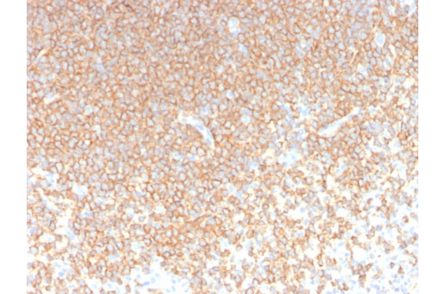 Immunohistochemistry - Anti-CD45RA Antibody [rPTPRC/1131] - BSA and Azide free (A252981) - Antibodies.com
