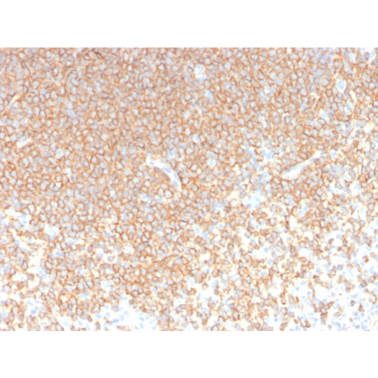 Immunohistochemistry - Anti-CD45RA Antibody [rPTPRC/1131] - BSA and Azide free (A252981) - Antibodies.com