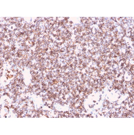 Immunohistochemistry - Anti-CD45 Antibody [rPTPRC/1461] - BSA and Azide free (A252982) - Antibodies.com