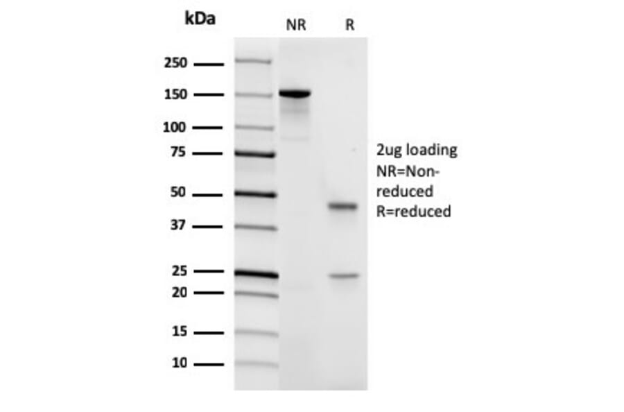SDS-PAGE - Anti-CD45 Antibody [rPTPRC/1461] - BSA and Azide free (A252983) - Antibodies.com