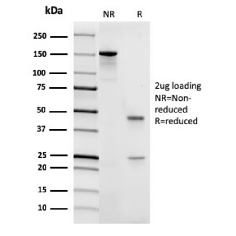 SDS-PAGE - Anti-CD45 Antibody [rPTPRC/1461] - BSA and Azide free (A252983) - Antibodies.com