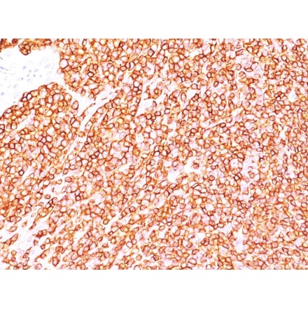 Immunohistochemistry - Anti-CD45 Antibody [SPM570] - BSA and Azide free (A252985) - Antibodies.com