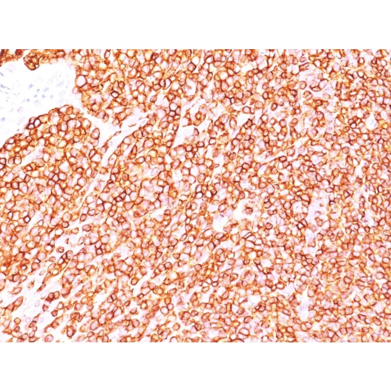 Immunohistochemistry - Anti-CD45 Antibody [SPM570] - BSA and Azide free (A252985) - Antibodies.com