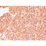 Immunohistochemistry - Anti-CD45 Antibody [SPM570] - BSA and Azide free (A252985) - Antibodies.com