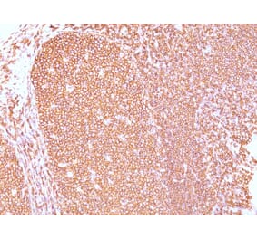 Immunohistochemistry - Anti-CD45RB Antibody [PD7/26] - BSA and Azide free (A252987) - Antibodies.com